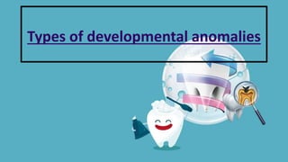 Types of developmental anomalies
 