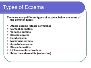 Different Types of Eczema ,[object Object],[object Object],[object Object],[object Object],[object Object],[object Object],[object Object],[object Object],[object Object],[object Object],[object Object]
