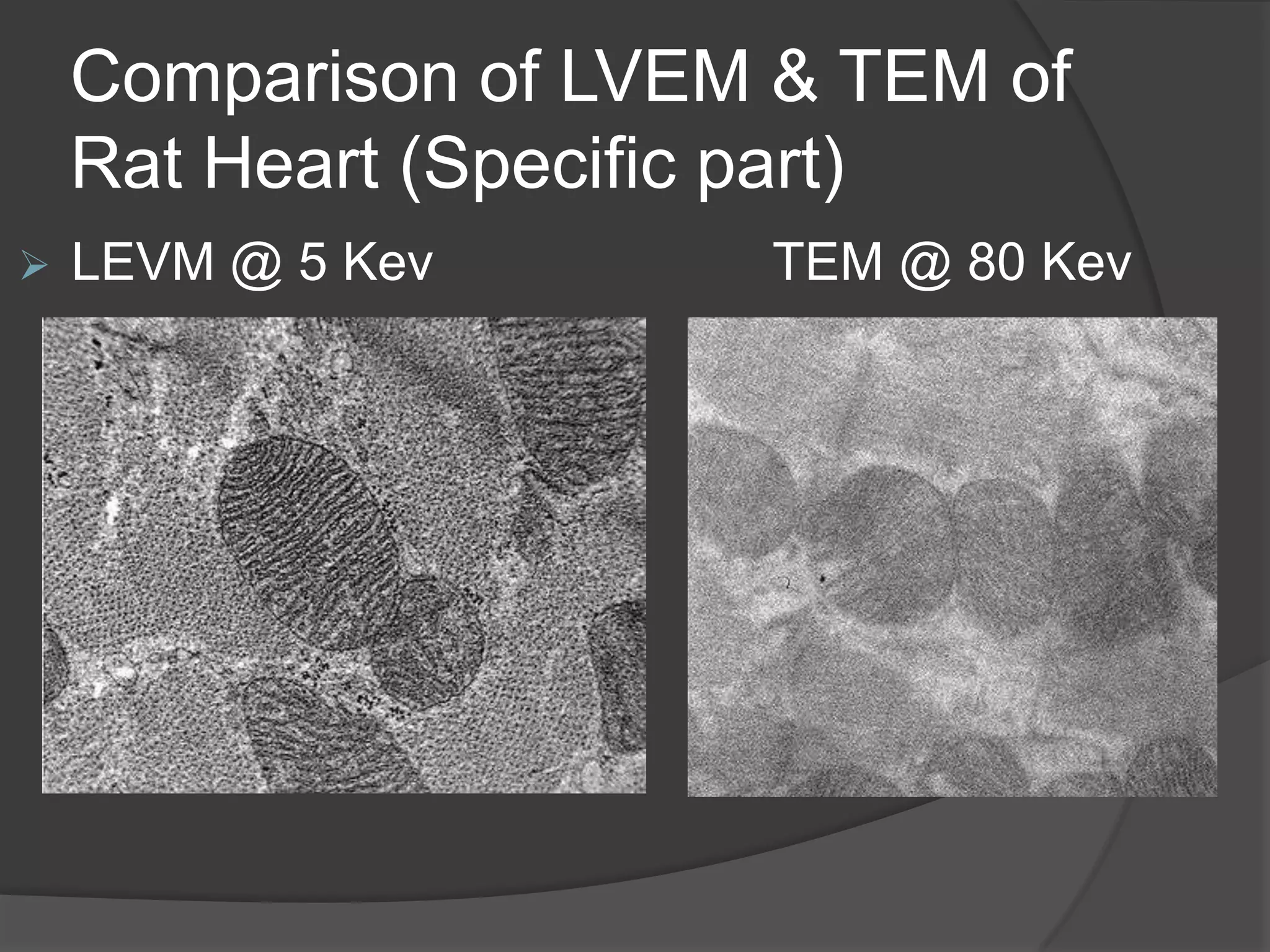 Comparison of LVEM & TEM of
Rat Heart (Specific part)
 LEVM @ 5 Kev TEM @ 80 Kev
 