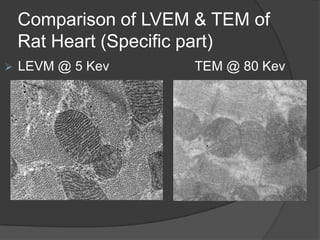 Comparison of LVEM & TEM of
Rat Heart (Specific part)
 LEVM @ 5 Kev TEM @ 80 Kev
 