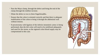 Two Fingerbreadths Types of enterostomy and its indications and complications.pptx
