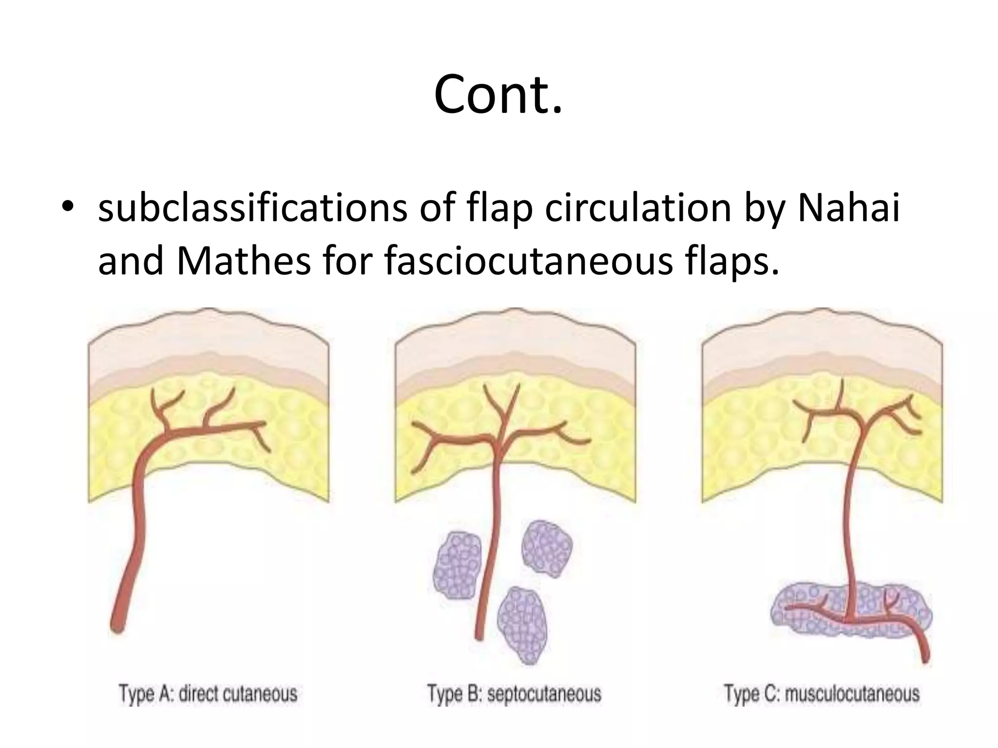 Cont.
• subclassifications of flap circulation by Nahai
and Mathes for fasciocutaneous flaps.
 