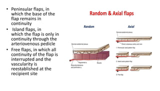 • Peninsular flaps, in
which the base of the
flap remains in
continuity
• Island flaps, in
which the flap is only in
continuity through the
arteriovenous pedicle
• Free flaps, in which all
continuity of the flap is
interrupted and the
vascularity is
reestablished at the
recipient site
 