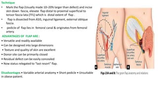 Technique
• Mark the flap (Usually made 10–20% larger than defect) and incise
skin down fascia, elevate flap distal to proximal superficial to
tensor fascia lata (TFL) which is distal extent of flap .
• flap is dissected from ASIS, inguinal ligament, external oblique
fascia.
• pedicle of flap lies in femoral canal & originates from femoral
artery.
ADVANTAGES OF FLAP ARE :
• Versatile and readily available
• Can be designed into large dimensions
• Texture and quality of skin are excellent
• Donor site can be primarily closed
• Residual defect can be easily concealed
• Now status relegated to “last resort” flap.
Disadvantages • Variable arterial anatomy • Short pedicle • Unsuitable
in obese patient.
 
