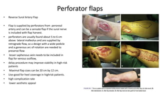Perforator flaps
• Reverse Sural Artery Flap
• Flap is supplied by perforators from peroneal
artery and can be a sensate flap if the sural nerve
is included with flap harvest.
• perforators are usually found about 5 to 6 cm
above lateral malleolus and are supplied by
retrograde flow, so a design with a wide pedicle
and a generous arc of rotation are needed to
preserve flow
• lesser saphenous vein needs to be included in
flap for venous outflow,
• delay procedure may improve viability in high-risk
patients
• Maximal flap sizes can be 20 cm by 12 cm.
• Use-good for heel coverage in highrisk patients.
• high complication rate
• lower aesthetic appeal
 