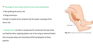 – Coverage of raw surface of donor site can be achieved by:
◊ Skin grafting the donor site
◊ Hinge technique -
A hinge is created at the recipient site for proper coverage of the
donor site.
– Postoperative: As there is propensity for movement the two limbs
are fixed by either applying plaster cast or by using an external fixator.
One must give deep vein thrombosis (DVT) prophylaxis to these
patients
 