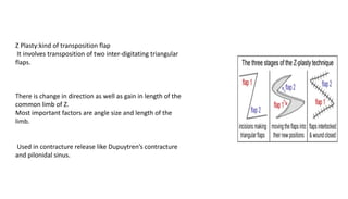 Z Plasty:kind of transposition flap
It involves transposition of two inter-digitating triangular
flaps.
There is change in direction as well as gain in length of the
common limb of Z.
Most important factors are angle size and length of the
limb.
Used in contracture release like Dupuytren’s contracture
and pilonidal sinus.
 