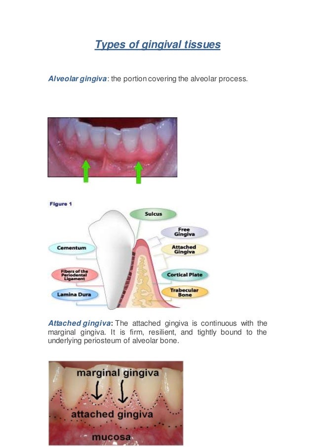 Types of gingival tissues