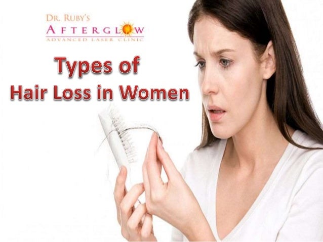 Types Of Hair Loss In Women
