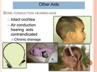 BONE CONDUCTION HEARING AIDS
 Intact cochlea
 Air conduction
hearing aids
contraindicated
 Chronic drainage
 Microtia
Other Aids
 