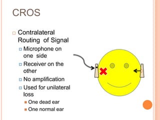 CROS
 Contralateral
Routing of Signal
 Microphone on
one side
 Receiver on the
other
 No amplification
 Used for unilateral
loss
 One dead ear
 One normal ear
 