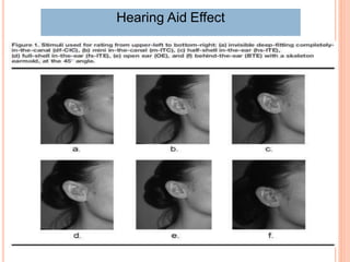 Hearing Aid Effect
 