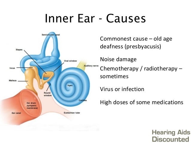 Types of hearing loss - Hearing Aids Discounted