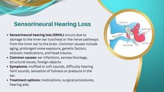 Types of hearing loss | Quality Hearing | PPTX