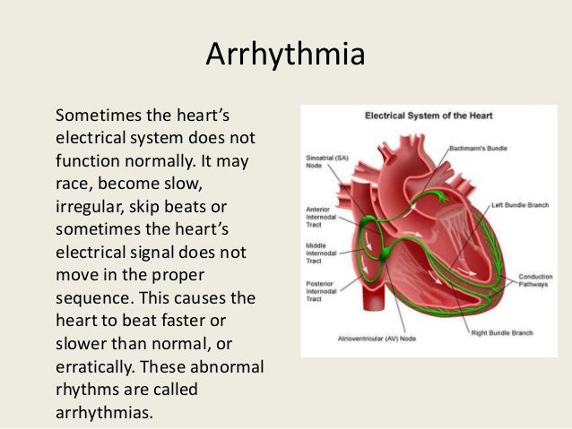 Different Types Of Heart Disease