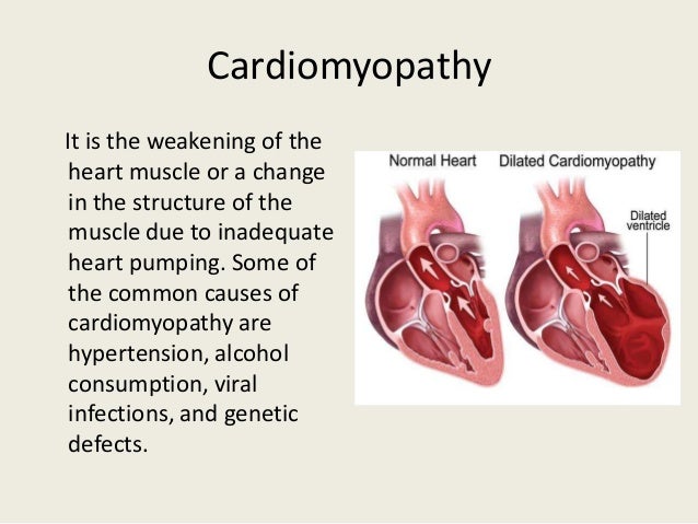 a description of the heart and its diseases The american heart association explains the various types of heart disease, also most people survive their first heart attack and return to their normal lives,. a description of the heart and its diseases The american heart association explains the various types of heart disease, also most people survive their first heart attack and return to their normal lives,.