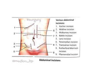 Incision Wikipedia TYPES OF INCISIONS. presentation lecture | PPTX