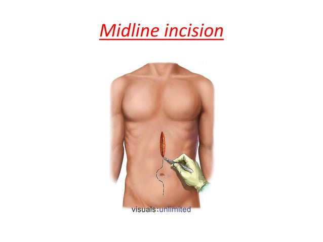 Axillary Incision Types TYPES OF INCISIONS. presentation lecture | PPTX