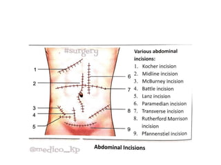 TYPES OF INCISIONS. presentation lecture | PPTX