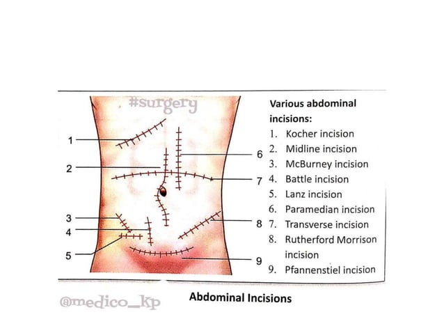 Shoulder Incision Names TYPES OF INCISIONS. presentation lecture | PPTX
