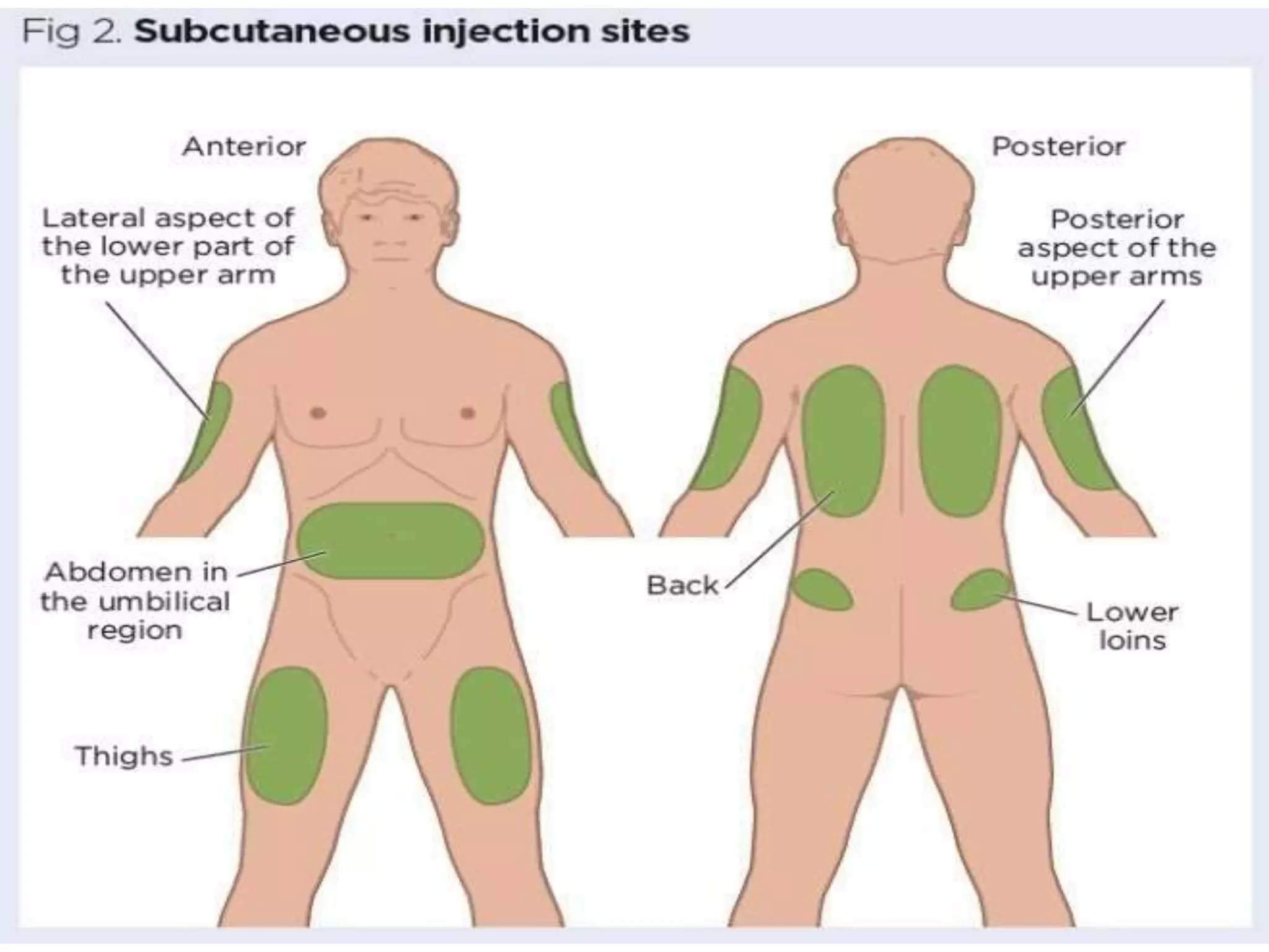typesofinjectionroutes-200608084224.pdf