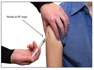 Types of injection routes | PPTX