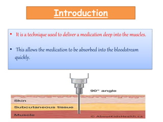 Db Level Injection TYPES OF INJECTION AND INJECTION SITES.pptx