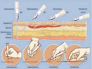 TYPES OF INJECTION AND INJECTION SITES.pptx