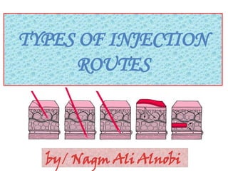 Comprehensive Guide to Types and Routes of Injection in Medical ...