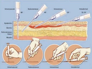 Medicine Injection Guide Comprehensive Guide to Types and Routes of Injection in Medical ...