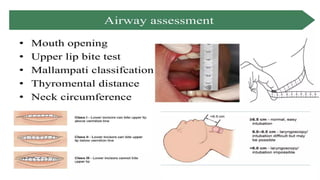 TYPES OF INTUBATION and its anaesthetic implications | PPTX