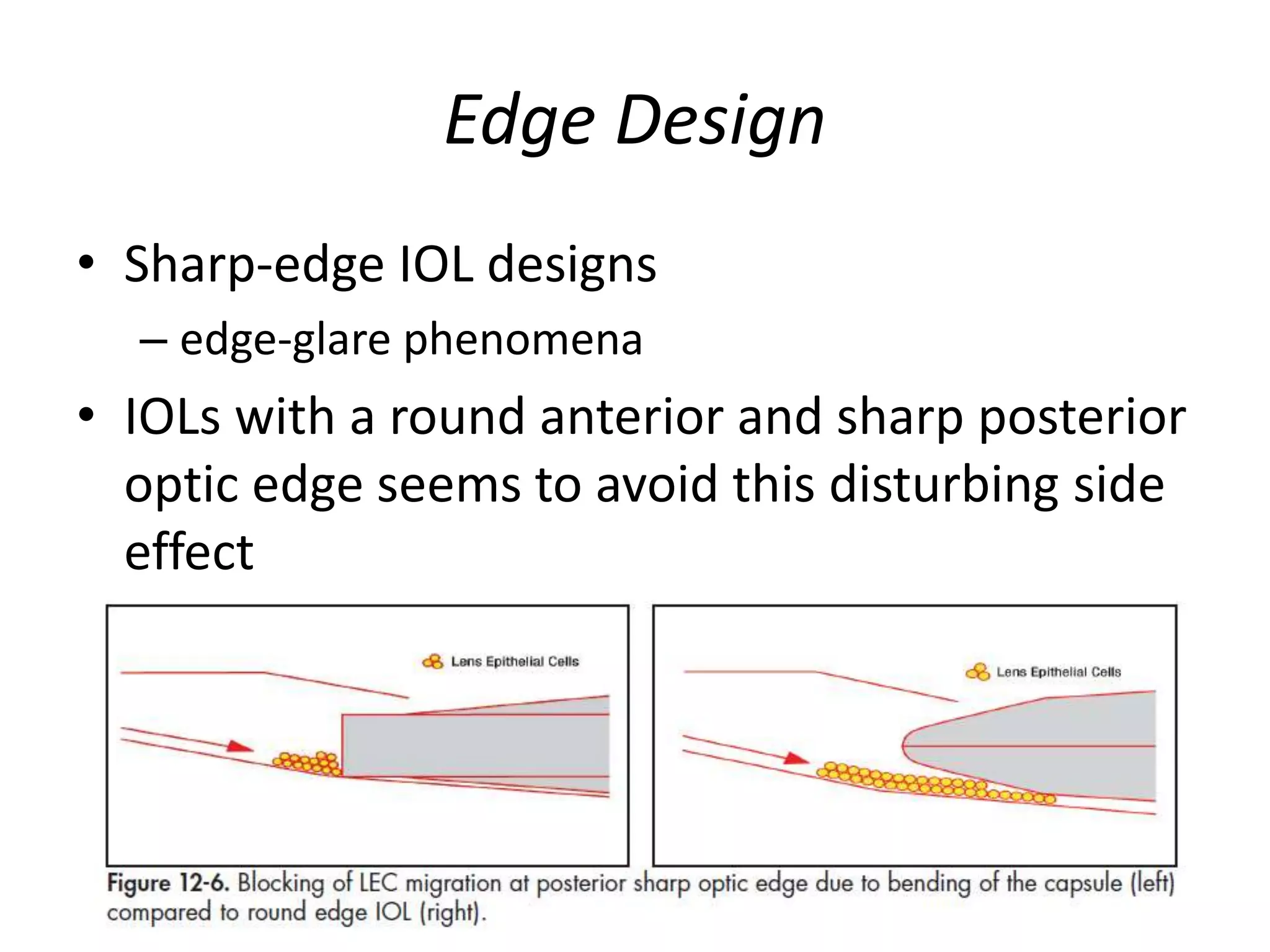 Edge Design
• Sharp-edge IOL designs
– edge-glare phenomena
• IOLs with a round anterior and sharp posterior
optic edge seems to avoid this disturbing side
effect
 