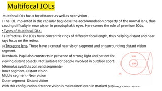 Types of IOL. Cataract instruments used it | PPTX