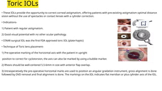 3 Iol Options Types of IOL. Cataract instruments used it | PPTX