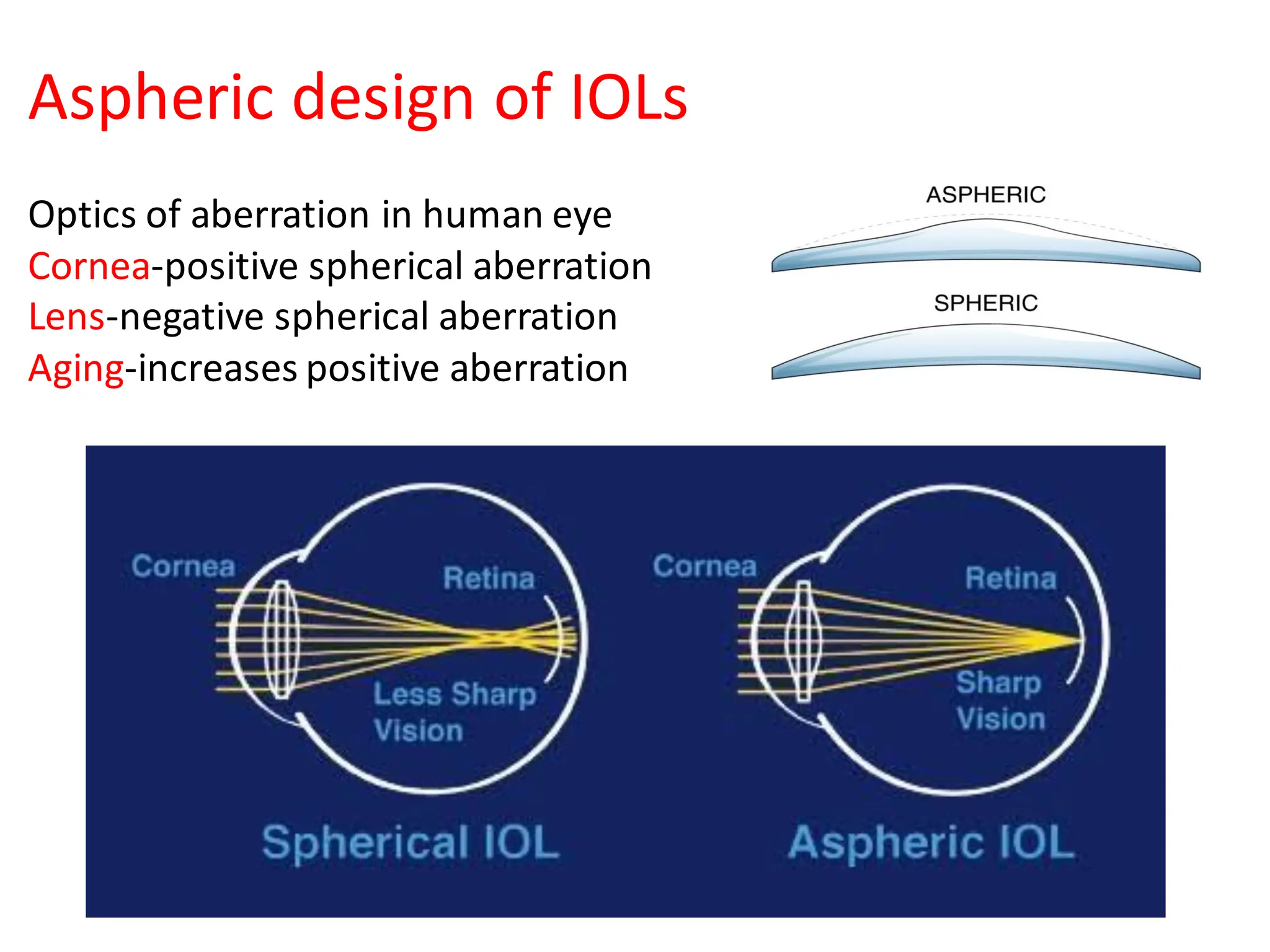 Aspheric design of IOLs
Optics of aberration in human eye
Cornea-positive spherical aberration
Lens-negative spherical aberration
Aging-increases positive aberration
 