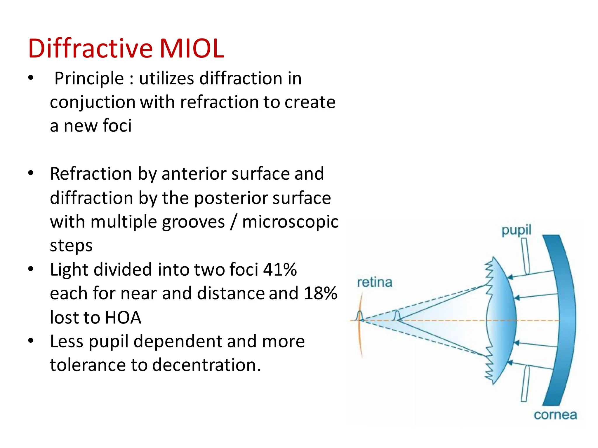 Diffractive MIOL
• Principle : utilizes diffraction in
conjuction with refraction to create
a new foci
• Refraction by anterior surface and
diffraction by the posterior surface
with multiple grooves / microscopic
steps
• Light divided into two foci 41%
each for near and distance and 18%
lost to HOA
• Less pupil dependent and more
tolerance to decentration.
 