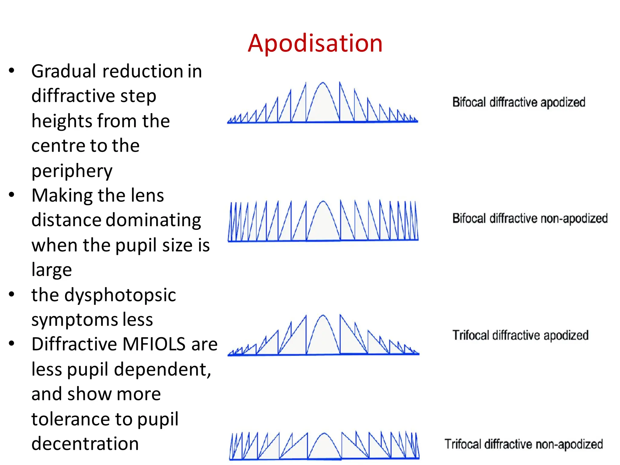 • Gradual reduction in
diffractive step
heights from the
centre to the
periphery
• Making the lens
distance dominating
when the pupil size is
large
• the dysphotopsic
symptoms less
• Diffractive MFIOLS are
less pupil dependent,
and show more
tolerance to pupil
decentration
Apodisation
 