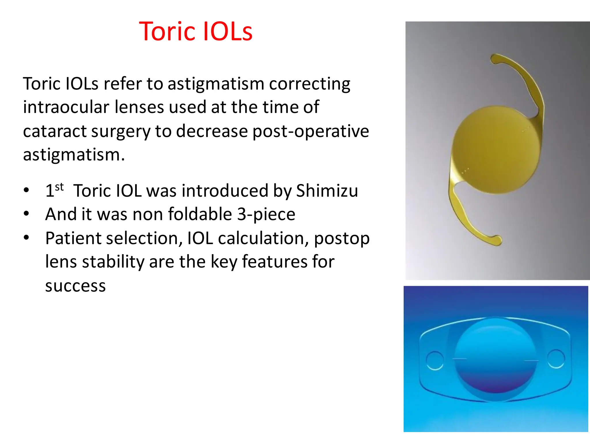 Toric IOLs refer to astigmatism correcting
intraocular lenses used at the time of
cataract surgery to decrease post-operative
astigmatism.
Toric IOLs
• 1st Toric IOL was introduced by Shimizu
• And it was non foldable 3-piece
• Patient selection, IOL calculation, postop
lens stability are the key features for
success
 