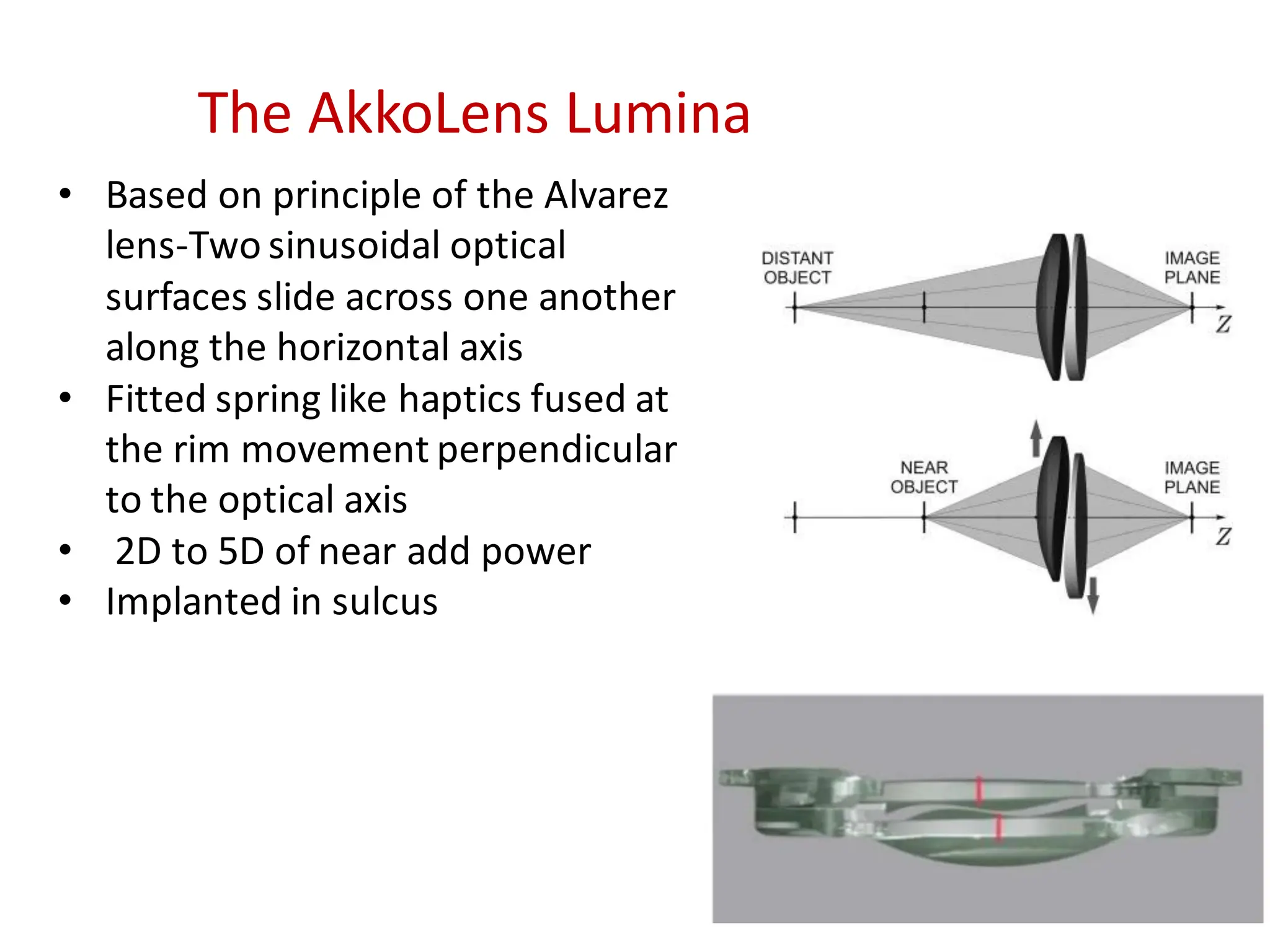 • Based on principle of the Alvarez
lens-Two sinusoidal optical
surfaces slide across one another
along the horizontal axis
• Fitted spring like haptics fused at
the rim movement perpendicular
to the optical axis
• 2D to 5D of near add power
• Implanted in sulcus
The AkkoLens Lumina
 