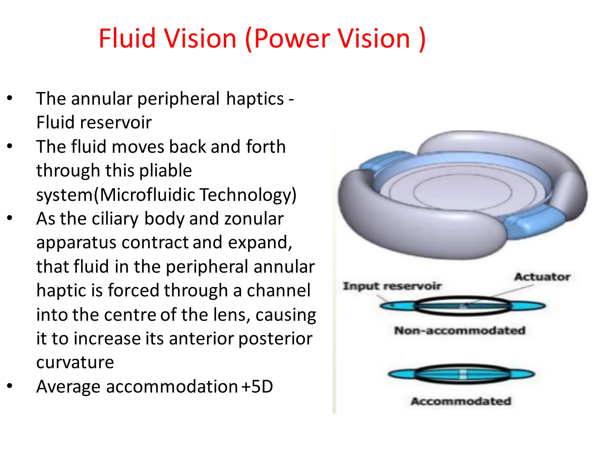 • The annular peripheral haptics -
Fluid reservoir
• The fluid moves back and forth
through this pliable
system(Microfluidic Technology)
• As the ciliary body and zonular
apparatus contract and expand,
that fluid in the peripheral annular
haptic is forced through a channel
into the centre of the lens, causing
it to increase its anterior posterior
curvature
• Average accommodation+5D
Fluid Vision (Power Vision )
 