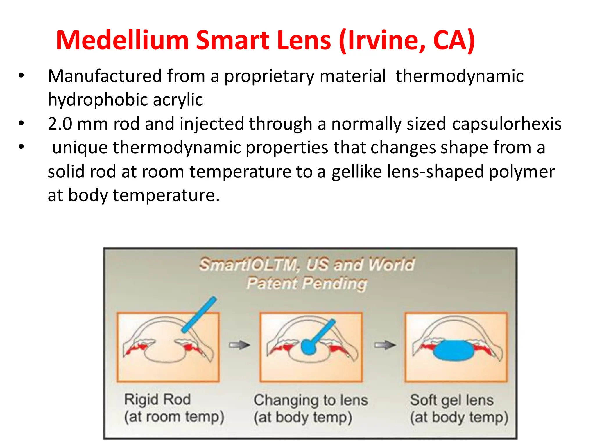 • Manufactured from a proprietary material thermodynamic
hydrophobic acrylic
• 2.0 mm rod and injected through a normally sized capsulorhexis
• unique thermodynamic properties that changes shape from a
solid rod at room temperature to a gellike lens-shaped polymer
at body temperature.
Medellium Smart Lens (Irvine, CA)
 