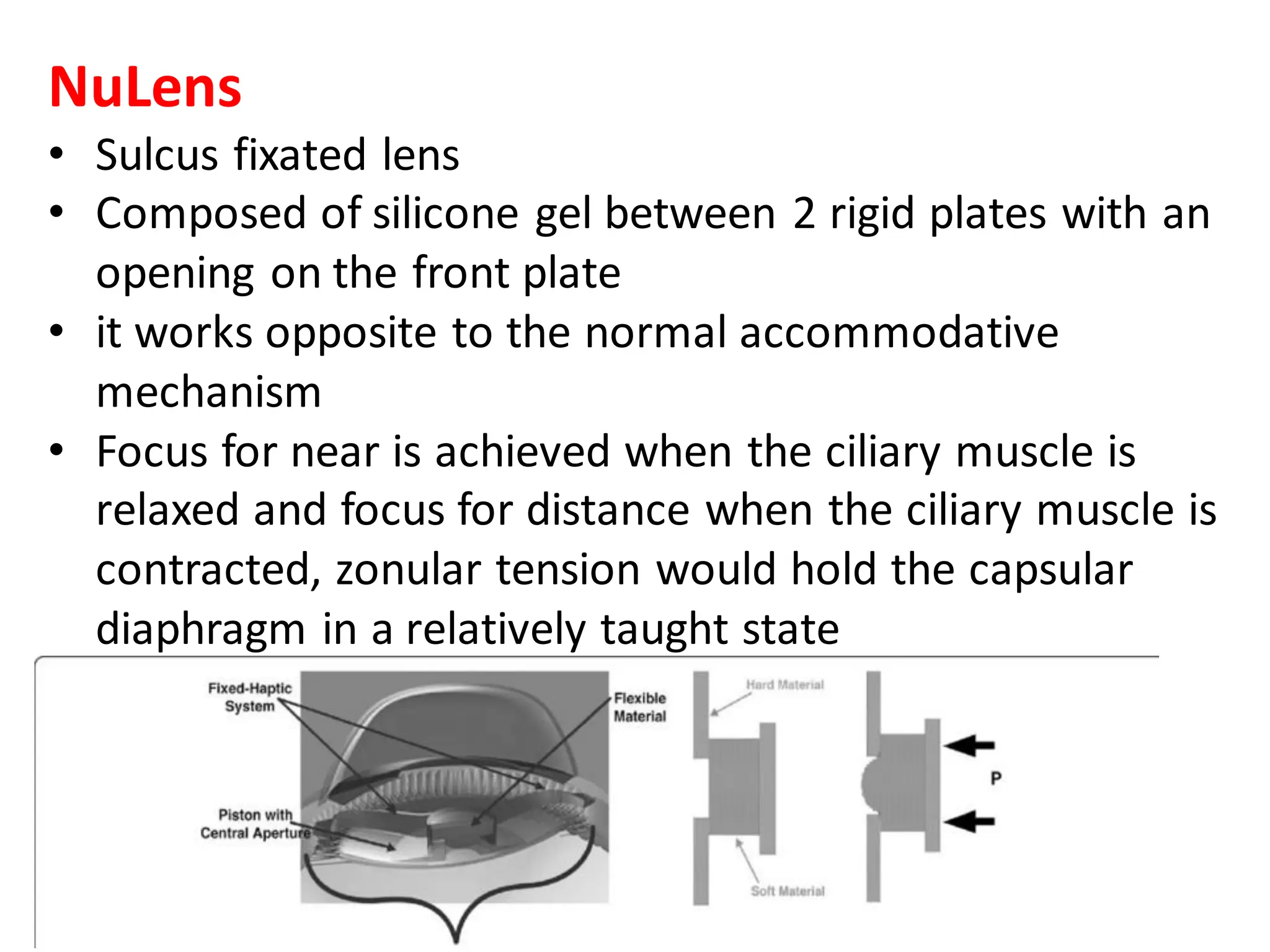 NuLens
• Sulcus fixated lens
• Composed of silicone gel between 2 rigid plates with an
opening on the front plate
• it works opposite to the normal accommodative
mechanism
• Focus for near is achieved when the ciliary muscle is
relaxed and focus for distance when the ciliary muscle is
contracted, zonular tension would hold the capsular
diaphragm in a relatively taught state
 