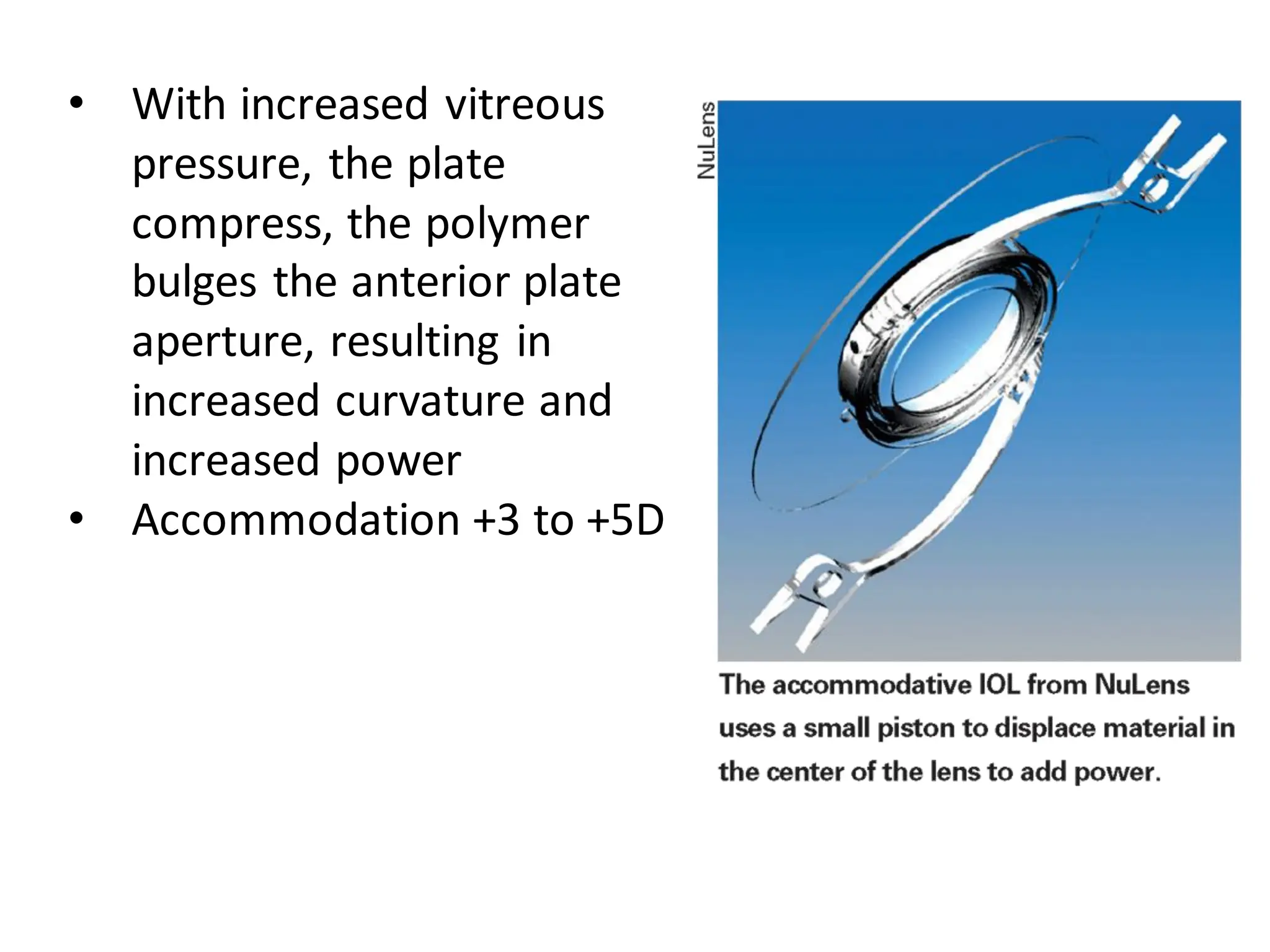 • With increased vitreous
pressure, the plate
compress, the polymer
bulges the anterior plate
aperture, resulting in
increased curvature and
increased power
• Accommodation +3 to +5D
 