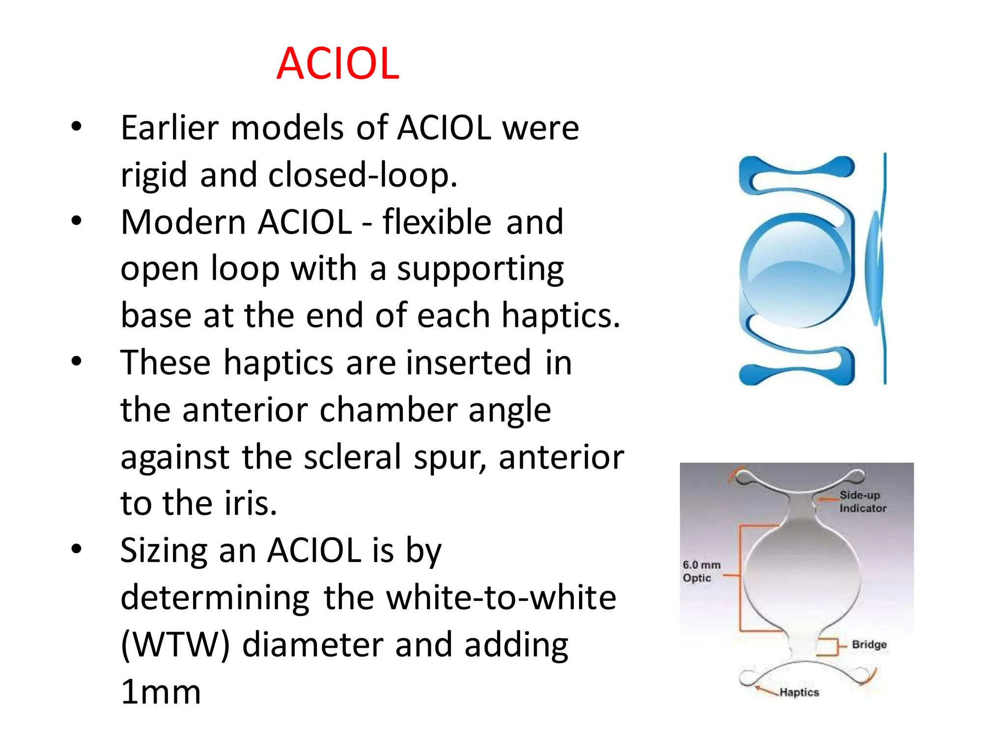 • Earlier models of ACIOL were
rigid and closed-loop.
• Modern ACIOL - flexible and
open loop with a supporting
base at the end of each haptics.
• These haptics are inserted in
the anterior chamber angle
against the scleral spur, anterior
to the iris.
• Sizing an ACIOL is by
determining the white-to-white
(WTW) diameter and adding
1mm
ACIOL
 