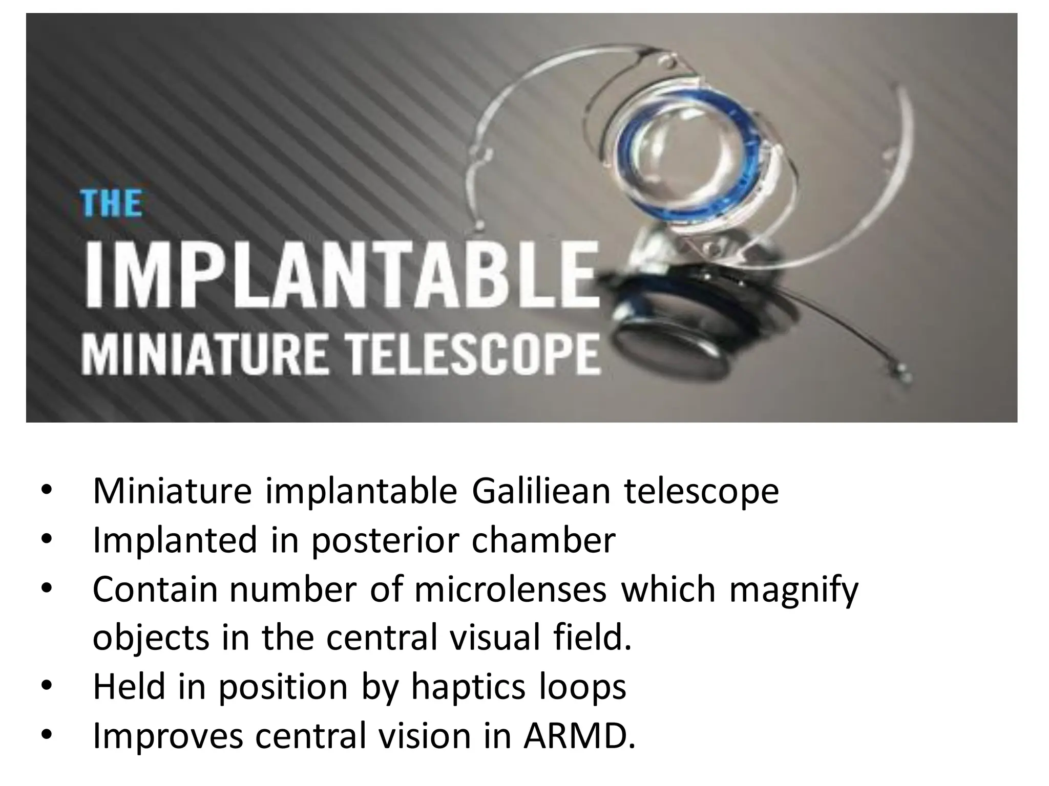 • Miniature implantable Galiliean telescope
• Implanted in posterior chamber
• Contain number of microlenses which magnify
objects in the central visual field.
• Held in position by haptics loops
• Improves central vision in ARMD.
 