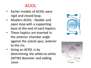 Types of IOL and Microlentics-2.pdf iol p | PDF