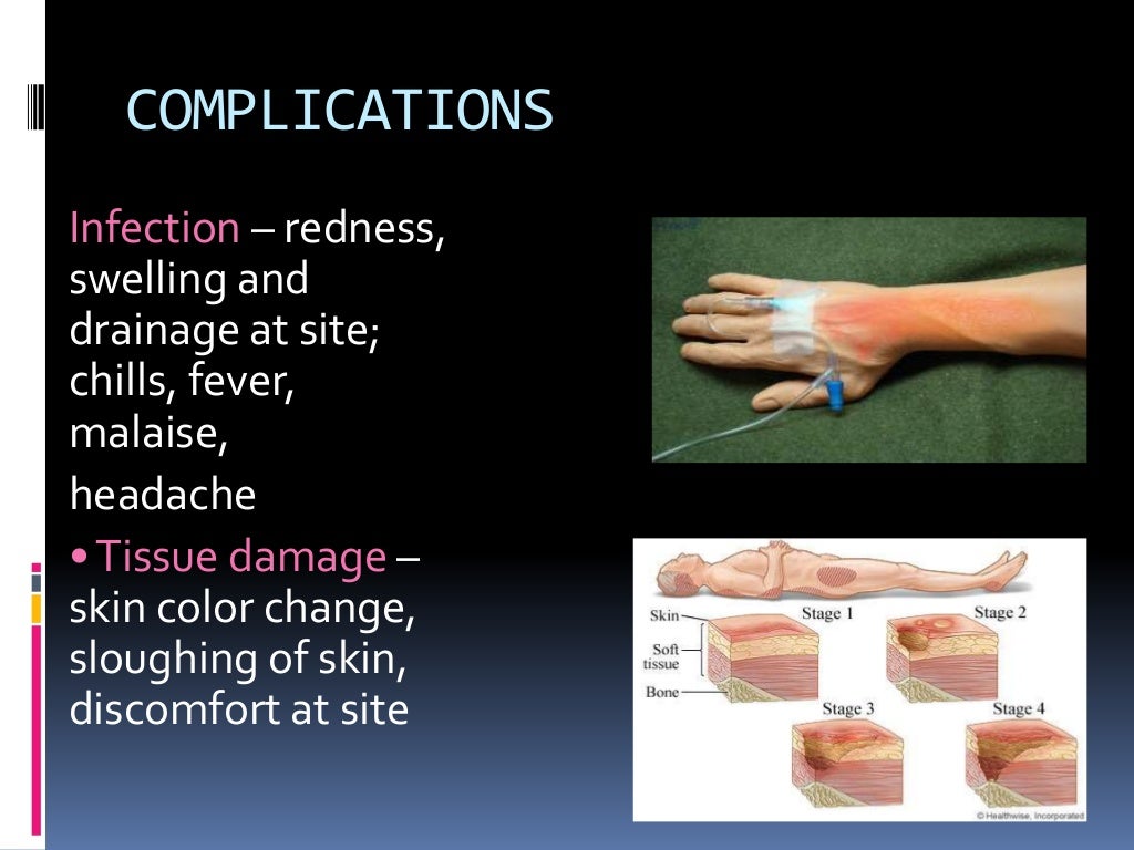 Types of iv fluids and uses