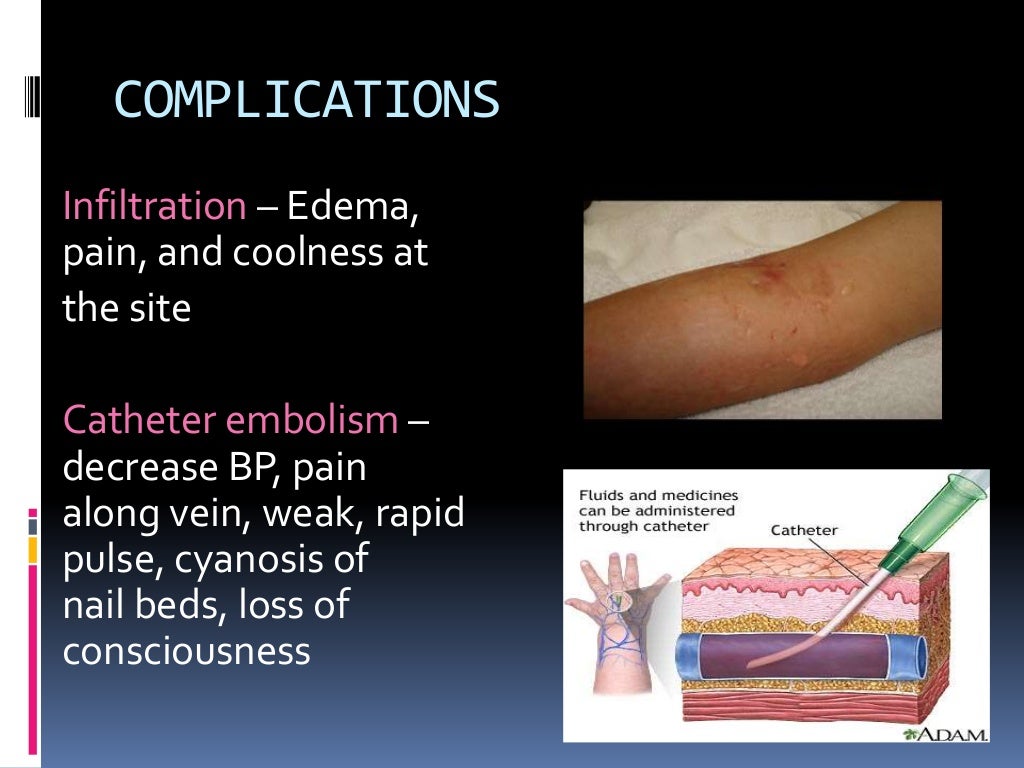 Types of iv fluids and uses