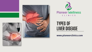 TYPES OF
LIVER DISEASE
www.pioneerclinics.com
 