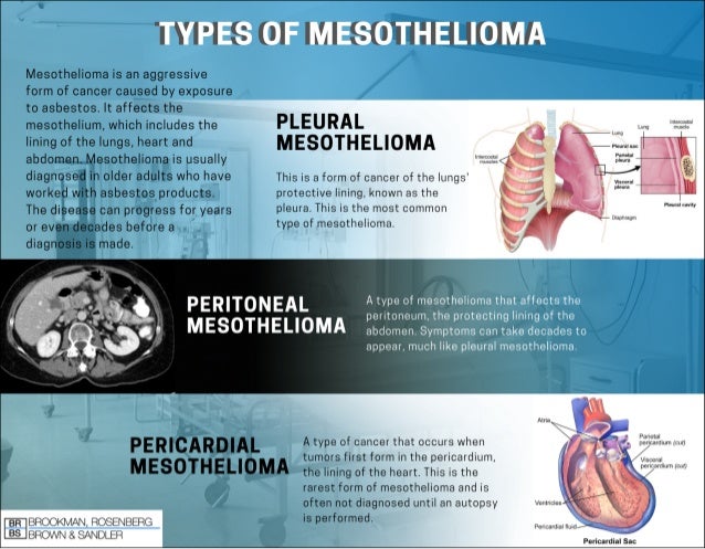 what is the main cause of mesothelioma